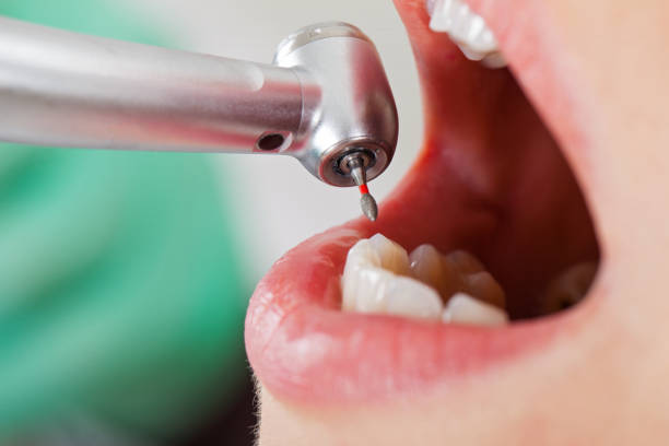 Best Emergency Dental Care for Trauma or Injury in Oak Hills Pce, LA